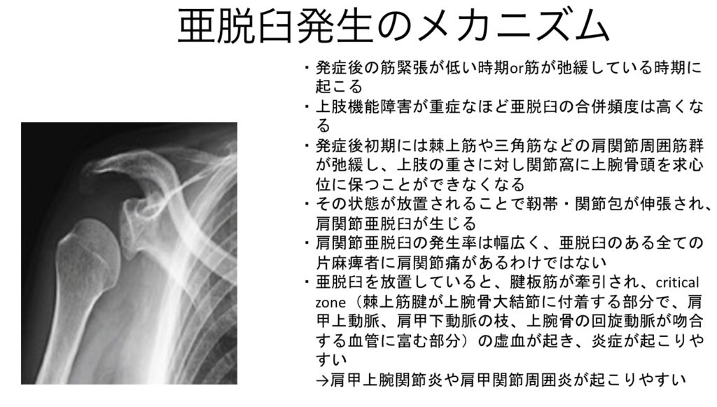脳卒中片麻痺者の上肢・手指の病態とリハビリ（亜脱臼予防、肩関節痛