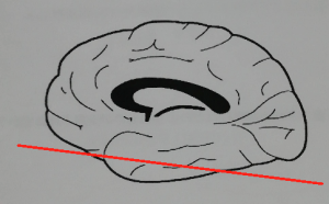 リハビリに役立つ脳画像!脳部位と機能局在、脳のつながり ...
