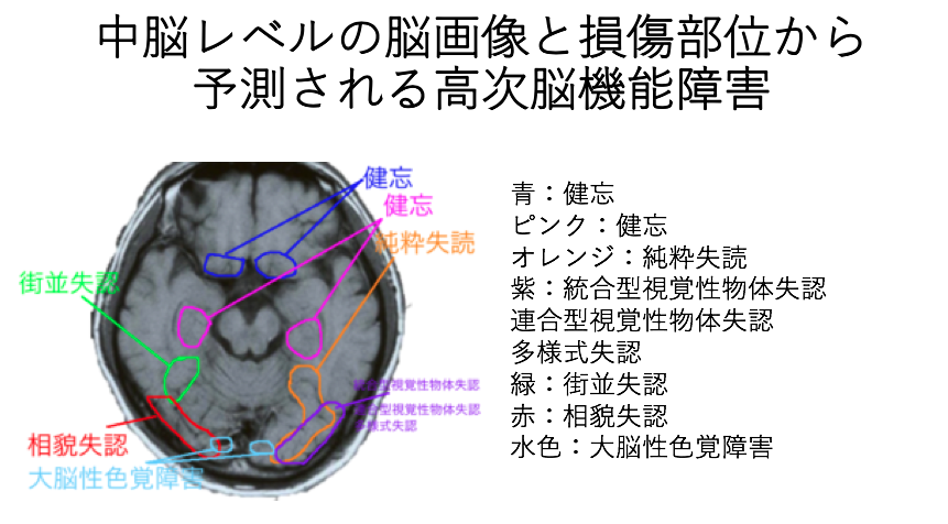 中脳レベルの脳画像と 損傷部位から予測される高次脳機能障害 自分でできるボディワーク